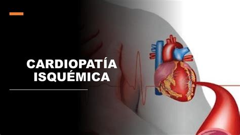 A Fisiopatologia Da Cardiopatia Isquêmica Envolve Especificamente Dois Processos