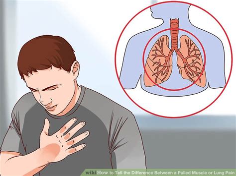 Sharp Pain Left Rib Cage When Breathing Ovulation Symptoms