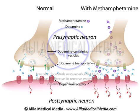 Alila Medical Media Action Of Methamphetamine On Dopaminergic Synapse Medical Illustration