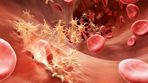 Oorzaken, symptomen, behandeling, getuigenissen, nieuws. FDA Supports Hemophilia A treatment ACE910