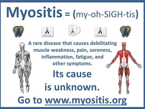 Myositis Myositis Education Chronic Illness Humor