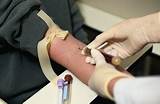 Images of Doctors Help Phlebotomy Training