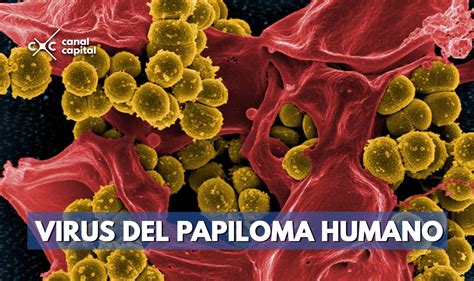 Virus Del Papiloma Humano Tipos