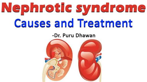Nephrotic Syndrome Causes And Treatment Youtube