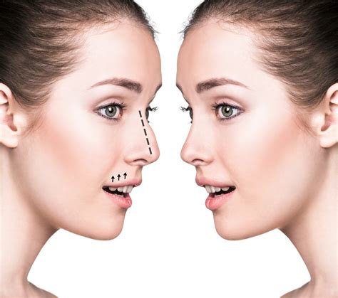 What Is The Best Age To Get A Nose Job Facial Plastic Surgery Omaha