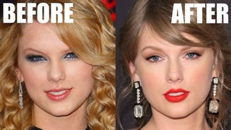 Taylor Swift Before And After Surgery Invest Records