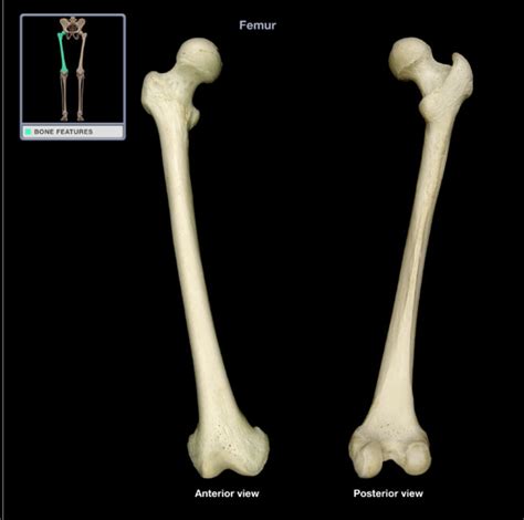 Femur Body Intercondylar Fossa Linea Aspera Patellar Groove