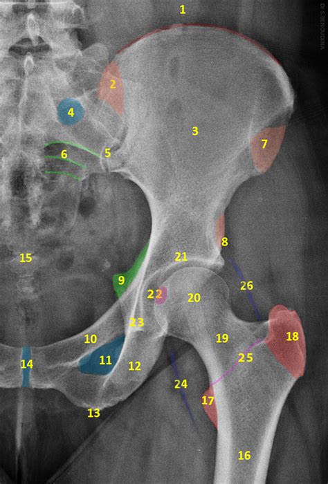 Normal Radiographic Anatomy Of The Hip Radiology Case Radiopaedia