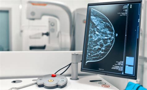 Mamografia O Que é Quando é Indicada E Como O Exame Funciona
