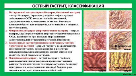 Катаральный холецистит диета Катаральный Гастрит Лечение И Диета — Похудение Диета Правильное Питание Катаральный Гастрит Лечение И Диета — Похудение Диета Правильное Питание Катаральный холецистит диета