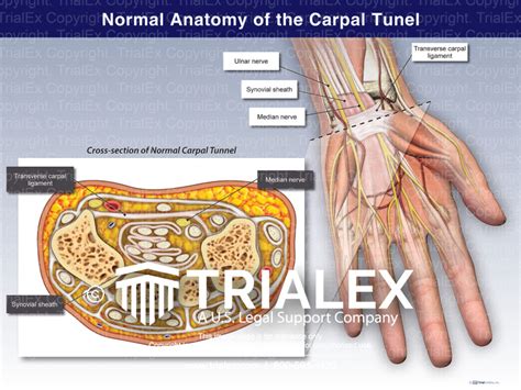 Normal Anatomy Of The Carpal Tunnel Trialexhibits Inc