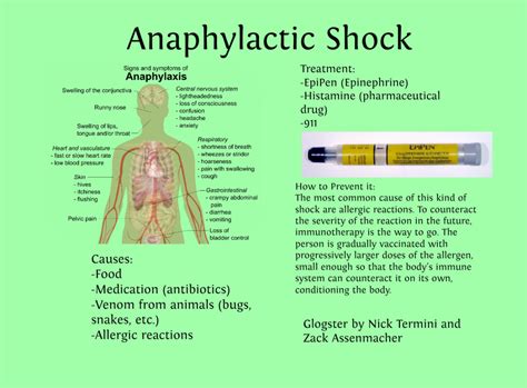 Anaphylaxis also is called anaphylactic shock. Anaphylactic Shock,Symptoms and Treatment | HubPages