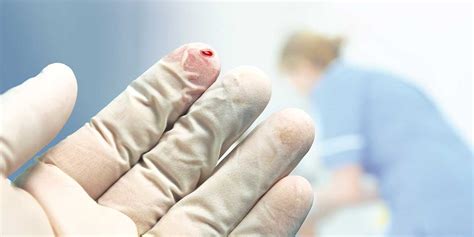 Needle Stick Injuries Copy Safety Matters