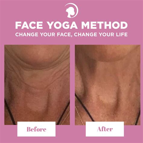 How To Reduce Neck Wrinkles In 2020 Face Yoga Method Face Exercises