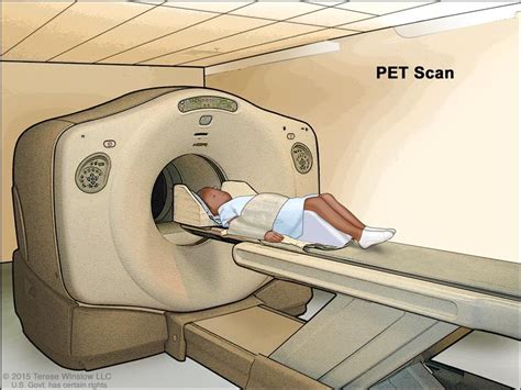 These exams help for in getting good results. Langerhans Cell Histiocytosis Treatment (PDQ®)—Patient ...