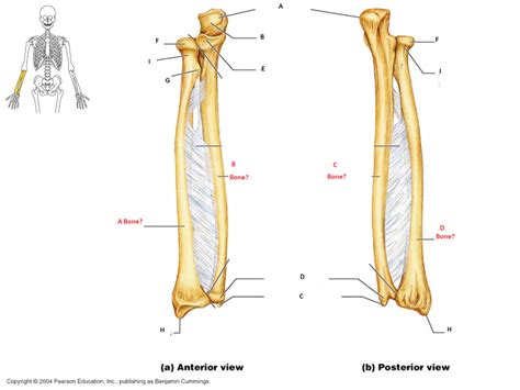 Radius And Ulna Of Right Forearm Anterior L Posterior R View Diagram Quizlet
