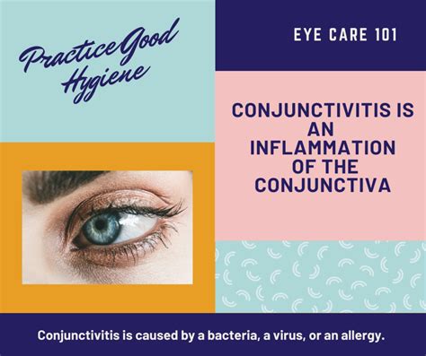 Conjunctivitis Types Causes Symptoms And Treatment Hubpages