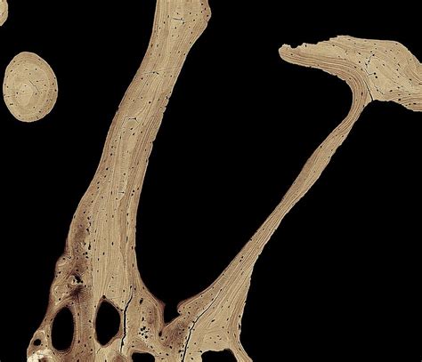 In the last decade, considerable technological improvements have been made to repair damaged bones and tissue, such as bone cross sections with implants for microscopic examinations. Bone Cross-section Photograph by Science Photo Library