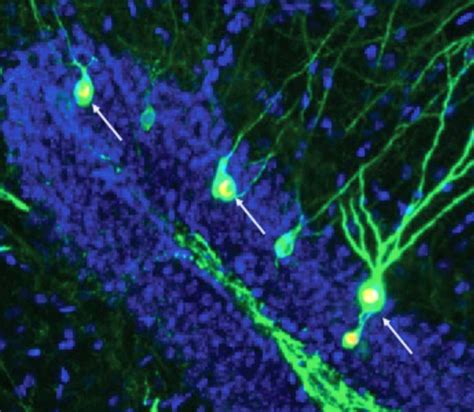 Boosting Neuron Formation To Restore Memory In Alzheimers Disease