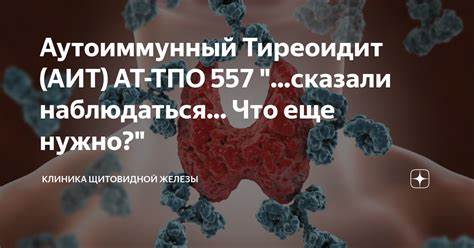 Аутоиммунный тиреоидит щитовидной железы диета Аутоиммунный Тиреоидит (АИТ) АТ-ТПО 557 "...сказали наблюдаться... Что Аутоиммунный Тиреоидит (АИТ) АТ-ТПО 557 "...сказали наблюдаться... Что Аутоиммунный тиреоидит щитовидной железы диета