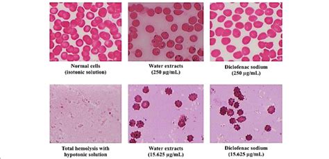 Appearance Of Erythrocytes Before And After The Treatment With The