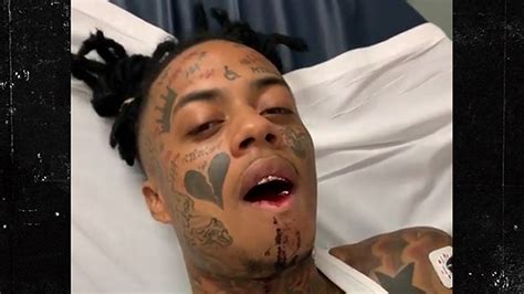 Rapper Boonk Recovers From Broken Jaw Surgery After Getting Punched