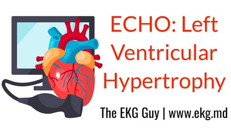 Left Ventricular Hypertrophy Echo Course L The Ekg Guy Video Youtube