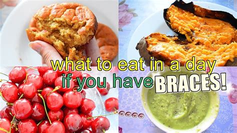Maybe you would like to learn more about one of these? WHAT TO EAT IN A DAY IF YOU HAVE BRACES! - YouTube