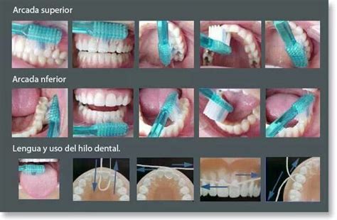 Técnica Del Cepillado Y Uso Del Hilo Dental Hilo Dental Dental