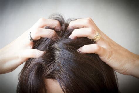 Hair loss has many causes. Female Hair Loss Causes - Hair Loss Tips For Women - Viral ...