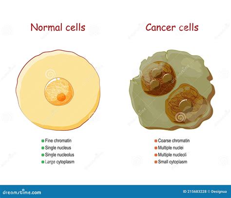 Cancer And Normal Cells Comparison And Difference Stock Vector