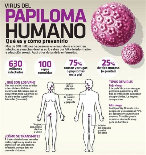 La Presencia De Vph Puede Provocar C Ncer C Rvico Uterino Esta Enfermedad Puede Prevenirse