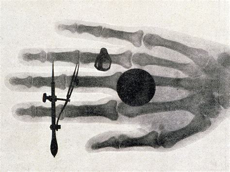 Wilhelm Roentgen Discovers The X Ray A Picture From The Past Art