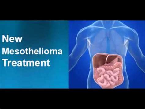 The average survival rate for 1 year after diagnosis is 73%, 3 years after diagnosis is 22.9%, and 5 years after diagnosis is 10%. MESOTHELIOMA SURVIVAL RATE - YouTube