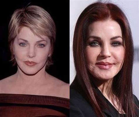 7 Worst Plastic Surgeries Fails In Hollywood Top Ten Lists Of Everything