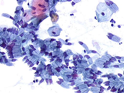 Cytopathology Of The Uterine Cervix Digital Atlas