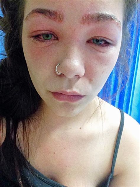 Tylah Durie 16 Almost Blinded After Reaction To Eyebrow Tint Metro News