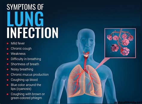 5 Signs and Symptoms of lung infection - My Health Only