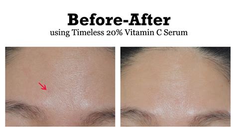 We did not find results for: One thing that kept Timeless 20% Vitamin C Serum from ...