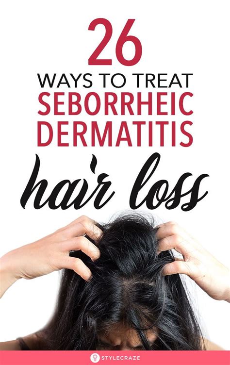 4 Remedies For Seborrheic Dermatitis Hair Loss And Treatment Seborrheic