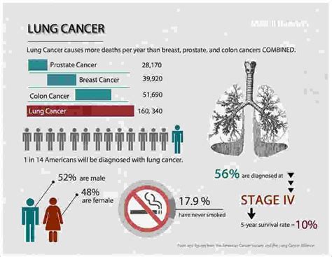 In medicine, lung cancer staging is the assessment of the extent to which a lung cancer has spread from its original source. Stage 4 Lung Cancer What To Expect - Cancer News Update