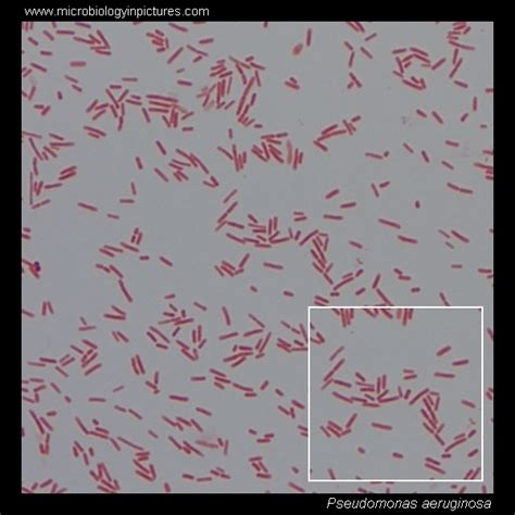 Pseudomonas Gram Stain And Cell Morphology Pseudomonas Aeruginosa