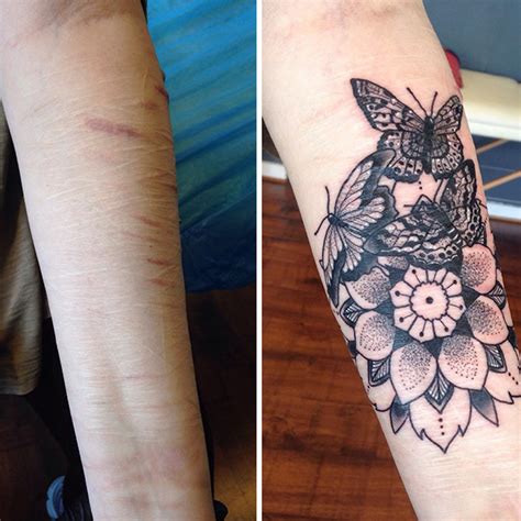 10 Amazing Scar Cover Up Tattoos Part 10