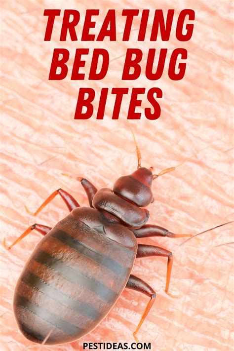 Arm Identifying Bed Bug Bites On Humans