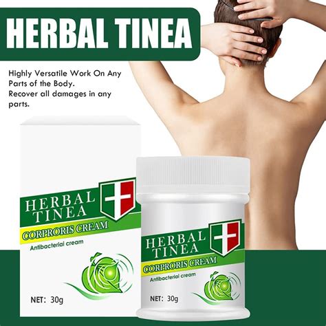 Buy Zuyoki Herbal Tinea Corporis Cream Tinea Skin Relief Itching Cream