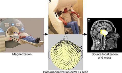 Magnetoencephalography Meg Advanced Imaging Technology Measures