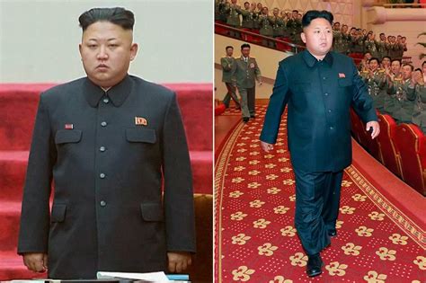 North Korea Dictator Kim Jong Un Undergoes Surgery After Breaking Both