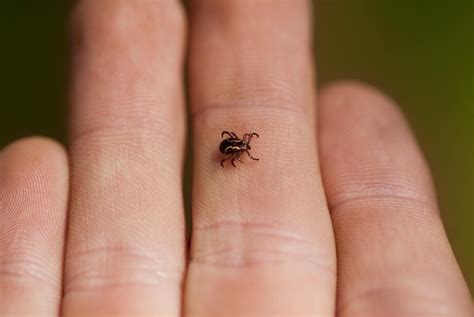 How To Treat Tick Bites On Pets Ticks Tick Removal Skin So Soft