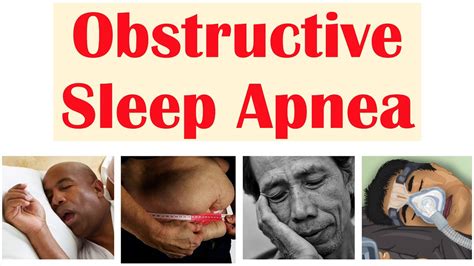 Obstructive Sleep Apnea OSA Risk Factors Signs Symptoms Complications Diagnosis