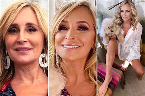 Rhonys Sonja Morgan Admits She Underwent A Facelift And A Necklift